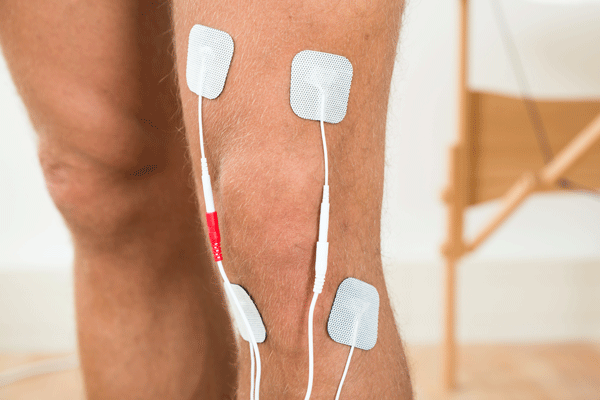 Electrical Stimulation of the Muscles