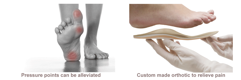 orthotics